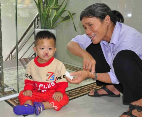 Spaltkind-Khahn-aus-Vietnam