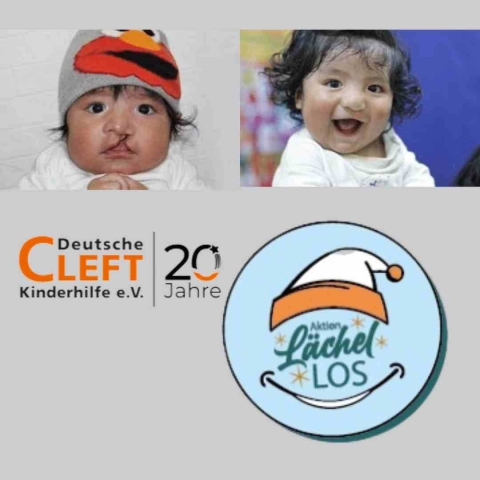 Bericht-Weihnachtsaktion2021-Cleft-Kinderhilfe
